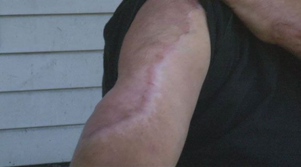 Man shocked by 4,000 volts of electricity lives to share story