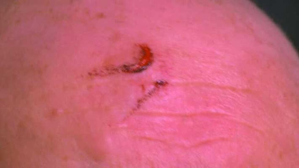 Ronald Kelly suffered a cut to his head when struck by the gun. (Source: James Thomas, WAVE 3...