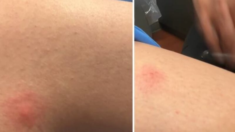 Comedian Luenell was hospitalized for a week after developing a serious infection from...